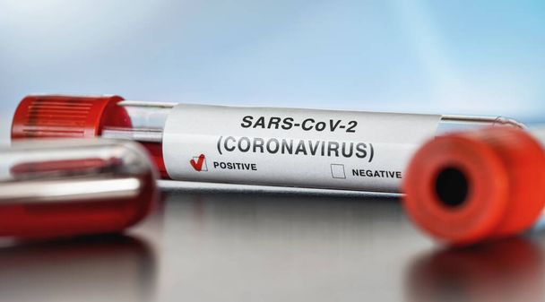 Sample vial with blood, label says SARS-CoV-2 coronavirus, positive result. Covid 19 testing during outbreak concept - 写真・画像