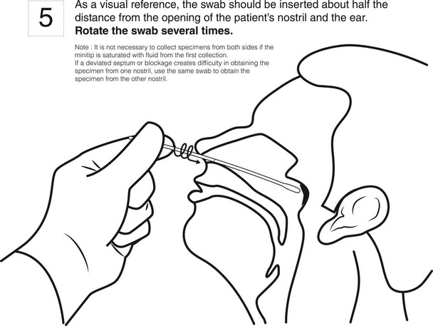 Passo 5: Como referência visual, o swab deve ser inserido a cerca de metade da distância da abertura da narina do paciente e da orelha. Gire o cotonete várias vezes. desenho de linha - Vetor, Imagem