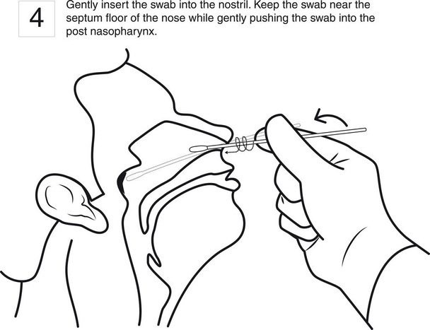 Gently insert the swab into the nostril. Keep the swab near the septum floor of the nose while gently pushing the swab into the post nasopharynx. step 4, line drawing - Vector, Image
