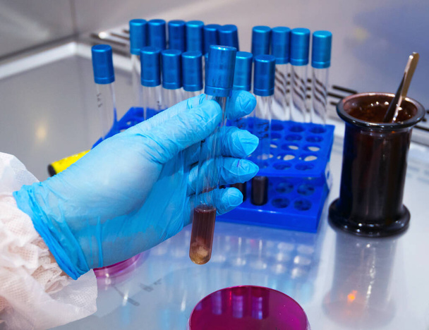 Mano sostiene una placa Petri con cultivo de bacterias en el laboratorio - Foto, Imagen