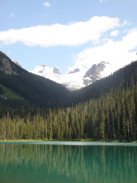 背景に雪をかぶった山々と晴れた夏の日にカナダのモレーン湖 - 写真・画像