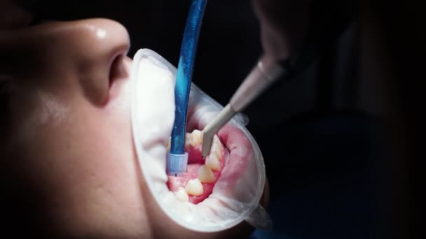 Jovem dentista Recepção no ortodontista Substituição de aparelho Polimento Gel ligação - Filmagem, Vídeo