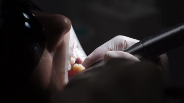 Mujer joven dentista Recepción en el ortodoncista Sustitución de los aparatos ortopédicos Puliendo la unión del gel - Metraje, vídeo