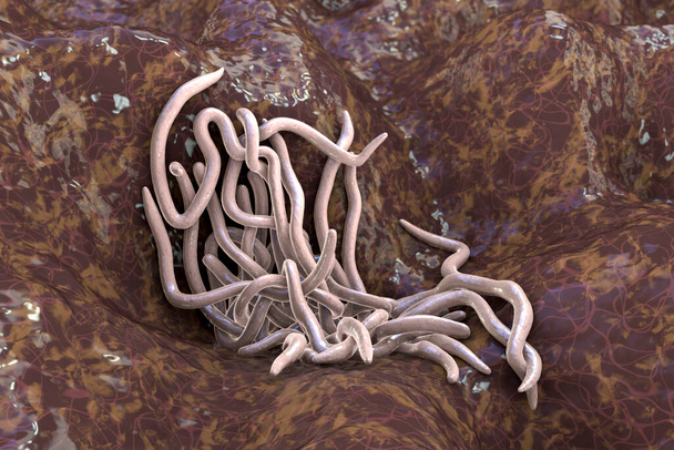 Parasitic worms, 3D illustration. Ascaris lumbricoides, Enterobius vermicularis and other round worms - Photo, Image