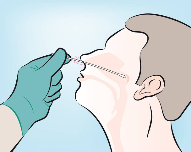 Krok 5: Jako odniesienie wzrokowe należy umieścić wymaz w odległości około połowy odległości od otworu nosa i ucha pacjenta. Obrócić wymaz kilka razy.. - Wektor, obraz