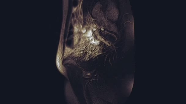 Couleur volumineuse IRM des organes pelviens féminins, cavité abdominale, tractus gastro-intestinal et la vessie - Séquence, vidéo