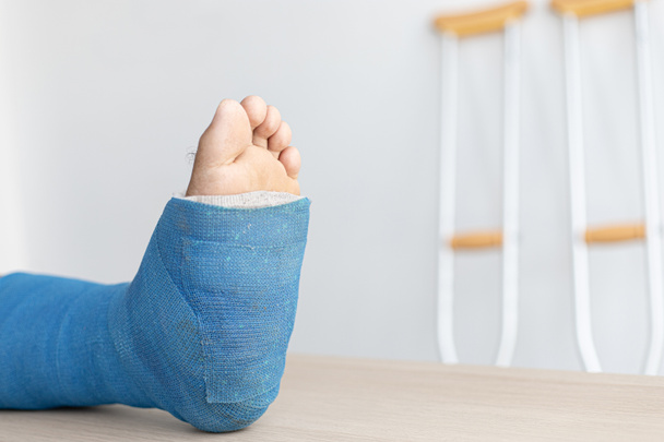 Attelle bleue de la cheville et du pied Bandages sur les jambes à la suite d'un accident de chute d'un jeune homme, plâtre bleu sur la cheville, béquilles aident à la marche du patient. - Photo, image