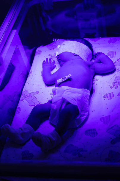 Newborn baby under an ultraviolet lamp. Selective focus. people. - Photo, Image