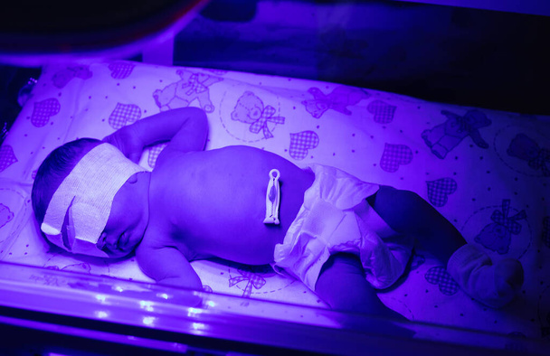 Neugeborenes unter einer UV-Lampe. Selektiver Fokus. Menschen. - Foto, Bild