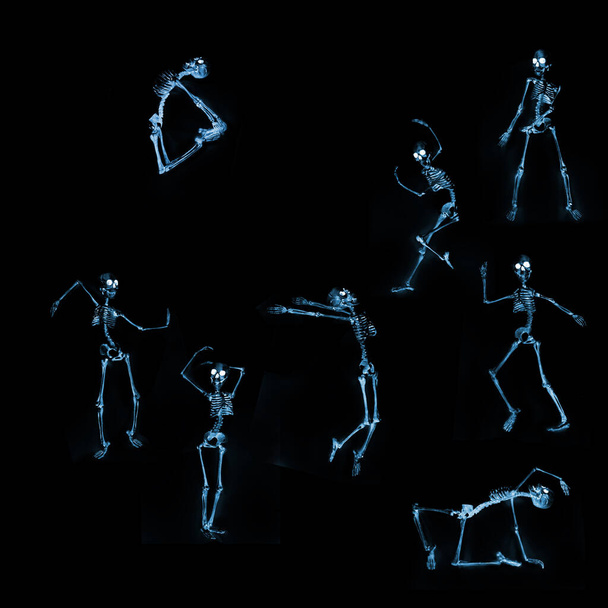Глупые танцевальные скелеты, как видно через рентгеновский аппарат - Фото, изображение