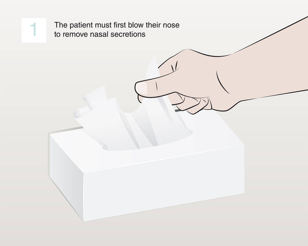 A betegnek először ki kell fújnia az orrát, hogy eltávolítsa az orrváladékot, majd kézzel kivesz egy szövetet egy dobozból. - Vektor, kép
