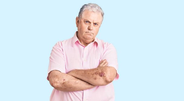 Senior grey-haired man wearing casual clothes skeptic and nervous, disapproving expression on face with crossed arms. negative person.  - Photo, Image