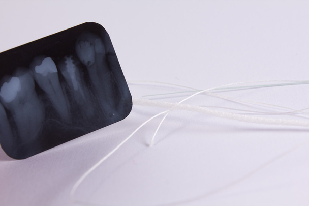 Image radiographique des dents et de la soie dentaire
 - Photo, image