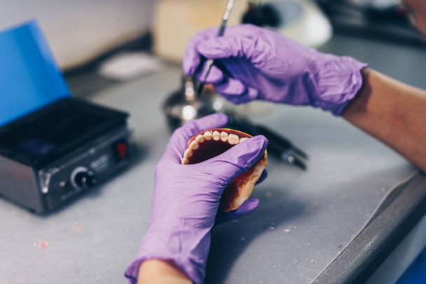 Dental prosthesis, prosthetics work. Prosthetist 's hands working on the denture. Selective focus. - Foto, Imagen