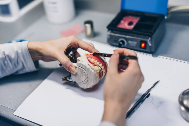 Dental prosthesis, female hands working on the denture. Selective focus. - Photo, Image