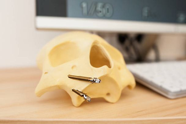 mock-up of a human skull, demonstration of dental prosthetics on mannequin tooth in a doctor's office - Photo, Image