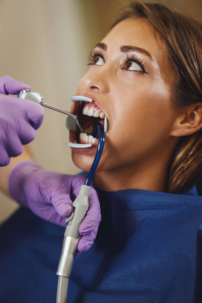 Η φωτογραφία μιας όμορφης νεαρής γυναίκας είναι στον οδοντίατρο. Κάθεται στην καρέκλα του οδοντίατρου και ο οδοντίατρος ετοιμάζεται να βάλει σιδεράκια στα δόντια της βάζοντας αισθητικές αυτο-ευθυγραμμισμένες γλωσσικές κλειδαριές. - Φωτογραφία, εικόνα