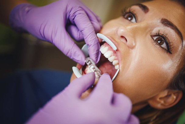 Vystřižený snímek zubaře staví neviditelného zubaře na zuby mladé ženy. Dává neviditelné odnímatelné rovnátka. - Fotografie, Obrázek