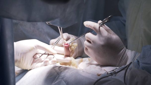 Close up of circumcision surgery on male penis. Action. Doctors are going to circumcise the foreskin of man genitals with medical equipment in operating room. - Φωτογραφία, εικόνα