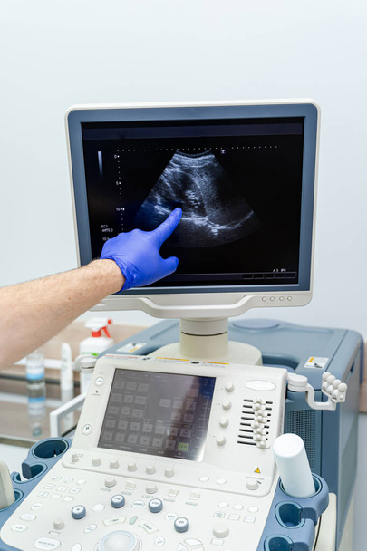 Ultrasound machine and ultrasonography. Medical equipment. Healthcare concept. Selective focus of process. - Foto, Bild