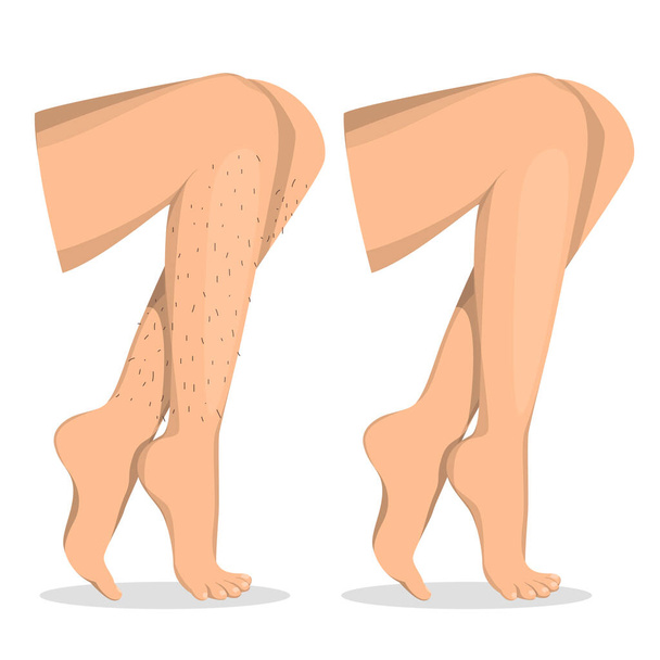 Депиляция ног до и после изолированного вектора. Женское тело, удаление волос. Уход за кожей, эпиляция. Иллюстрация красивого тела. - Вектор,изображение