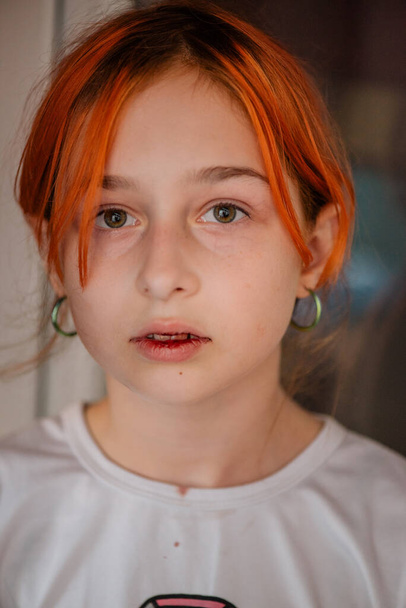 little girl with a broken lip. Girl with a broken lip. Teen hurt her lip - Fotografie, Obrázek
