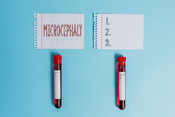Writing note showing Microcephaly. Business photo showcasing condition of abnormal smallness of circumference of the head Blood sample vial medical accessories ready for examination. - Photo, Image