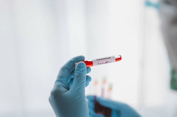 Back view of doctor hand wearing glove holding blood tube test with Coronavirus positive result in laboratory - Valokuva, kuva