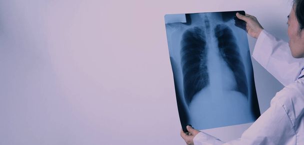Středního věku asijské ženy lékař stojící a držící rentgenový film nebo radiografii. hledá neobvyklé nebo onemocnění plic, které onemocnění z pandemie koronaviru - Fotografie, Obrázek