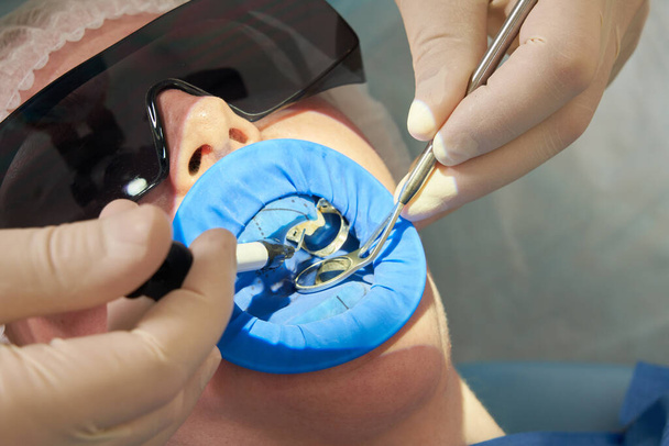 Fogászati kezelésben részesülő páciens fogorvosi rendelőben fogászati gát elleni védelemmel - Fotó, kép