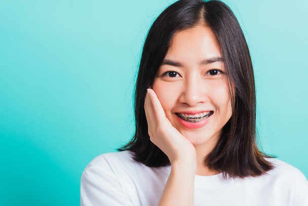Portrait of Asian teen beautiful young woman smile have dental braces on teeth laughing she touching her face by hand, studio shot isolated on a blue background, Medicine and dentistry concept - Фото, зображення