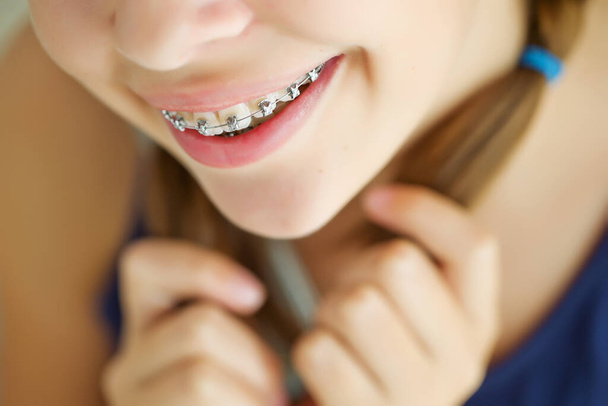 Close up portrait of smiling teenager girl showing dental braces.Isolated on white background. - Фото, зображення
