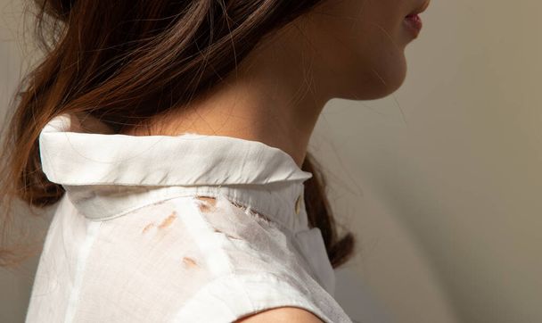 Young Woman wear Shirt and found out many Holes on white clothes, shoulder and neck parts were scratched from aged and poor quality clothing. copy space - Foto, immagini