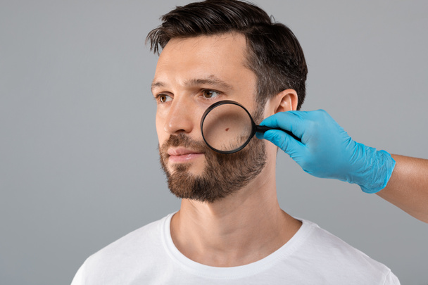 A mão do doutor que verifica a pele da cara do homem com Dermatoscope - Foto, Imagem