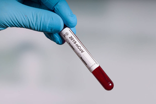 main dans les gants bleus tenant un tube à essai sanguin pour les tests de coronavirus devant un laboratoire  - Photo, image