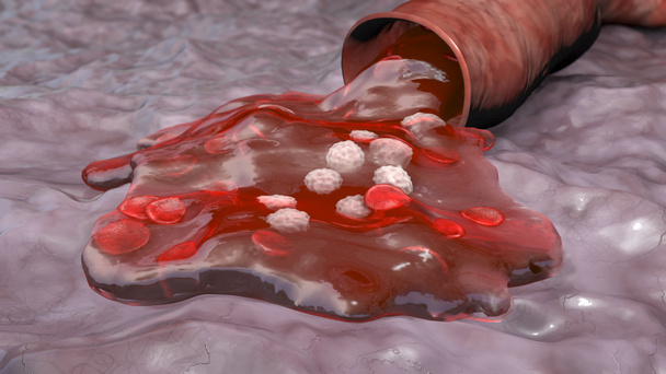 Blood flowing from the damaged blood vessel, hemorrhage, 3D illustration - Foto, afbeelding