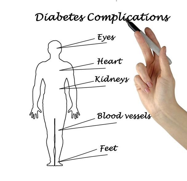  komplikace diabetu - Fotografie, Obrázek