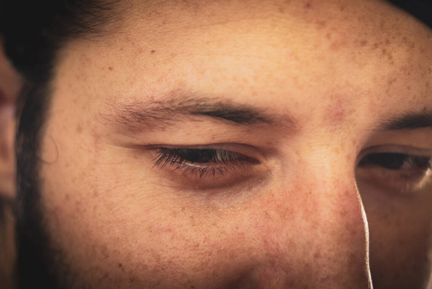 закрыть молодого человека глазными каплями - Фото, изображение
