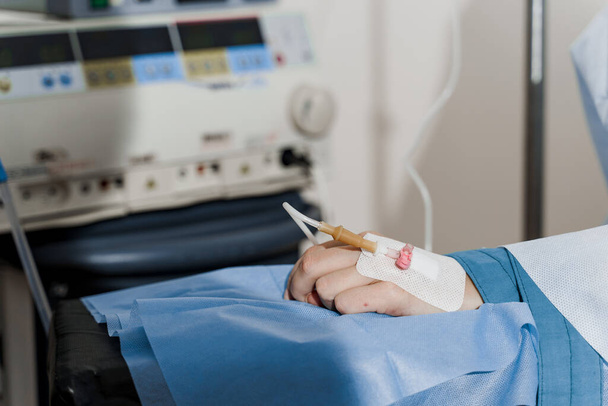 Catéter insertado con seguridad en la mano de la mujer en la operación plástica Anestesia para cirugía. - Foto, Imagen