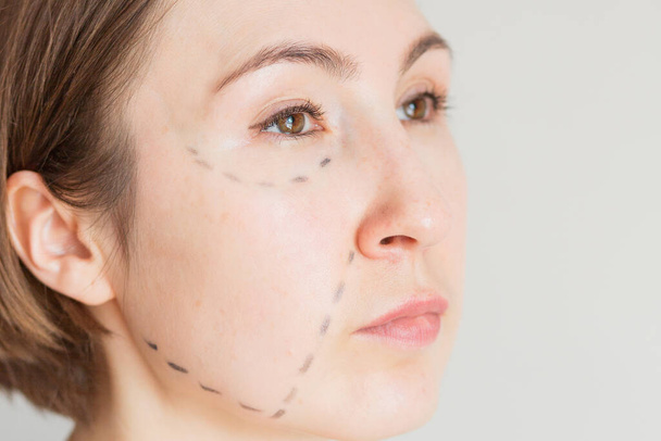 Woman face with marked zones for injection - Foto, immagini
