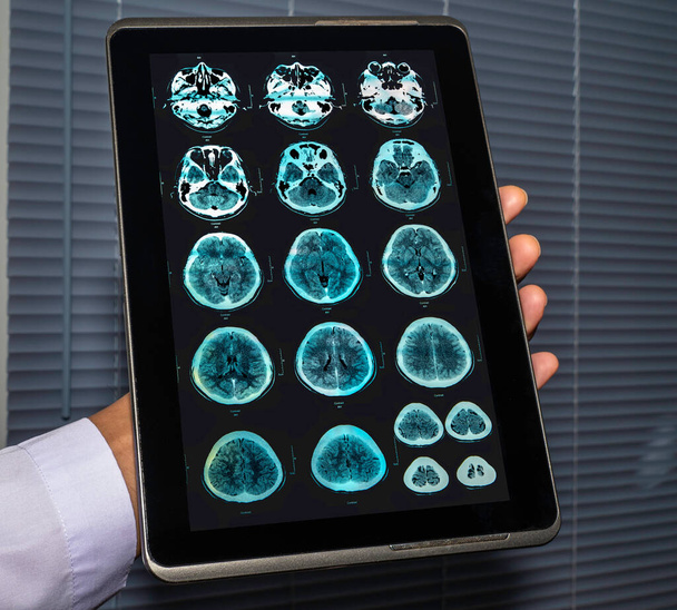 ressonância magnética imagem colorida (MRI) do cérebro. - Foto, Imagem