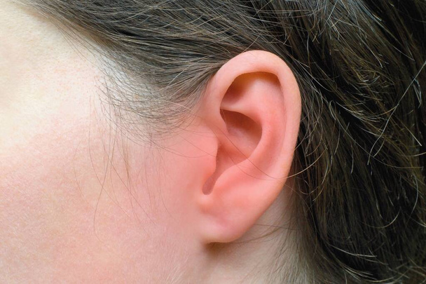 Oído de mujer con marcas rojas de inflamación, problema de salud - Foto, Imagen