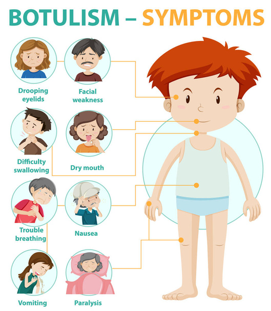 Botulismo síntomas información infografía ilustración - Vector, imagen