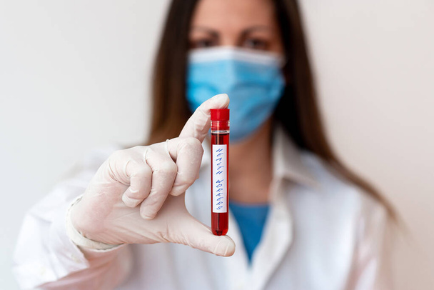 Word writing text Health Workers. Business concept for showing whose job to protect the health of their communities Laboratory blood test sample shown for medical diagnostic analysis result. - Photo, Image