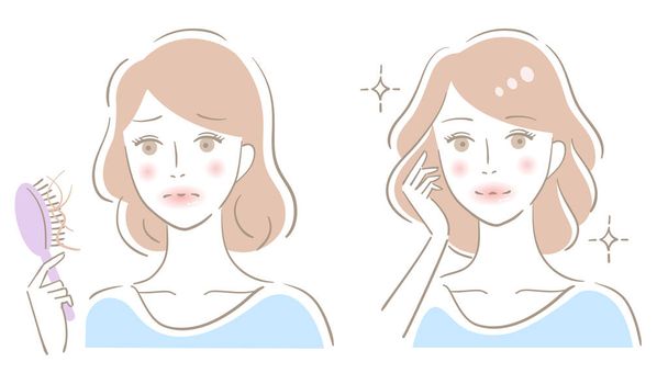 Hair loss woman before after illustration. Beauty and healthy hair care concept. - Vector, Image
