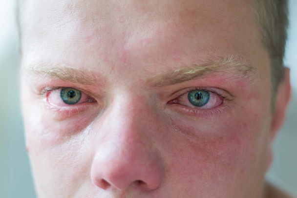 A kék szemű síró ember arca - Fotó, kép