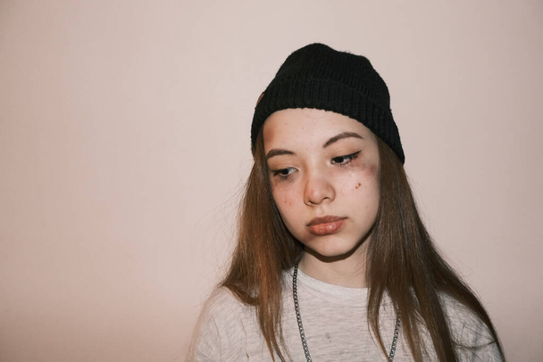 Teenager girl victim of domestic or street violence and abuse. on bright background.  - Foto, imagen