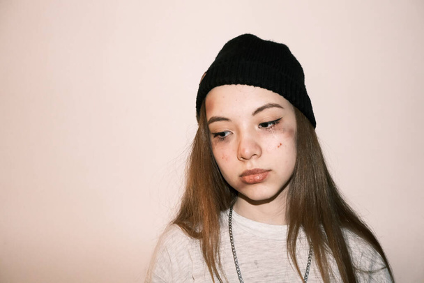 Teenager girl victim of domestic or street violence and abuse. on bright background.  - Φωτογραφία, εικόνα