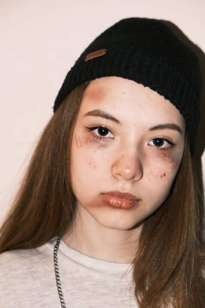 Teenager girl victim of domestic or street violence and abuse. on bright background.  - Foto, Imagem