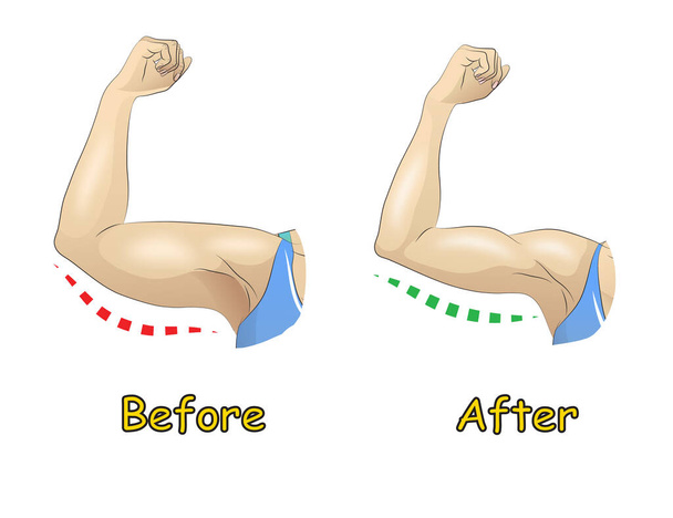 Brazo de mujer antes y después del entrenamiento, dieta o cirugía - Vector, Imagen